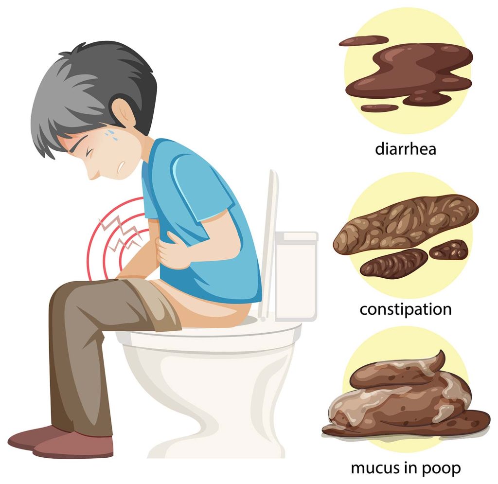 constipation-types
