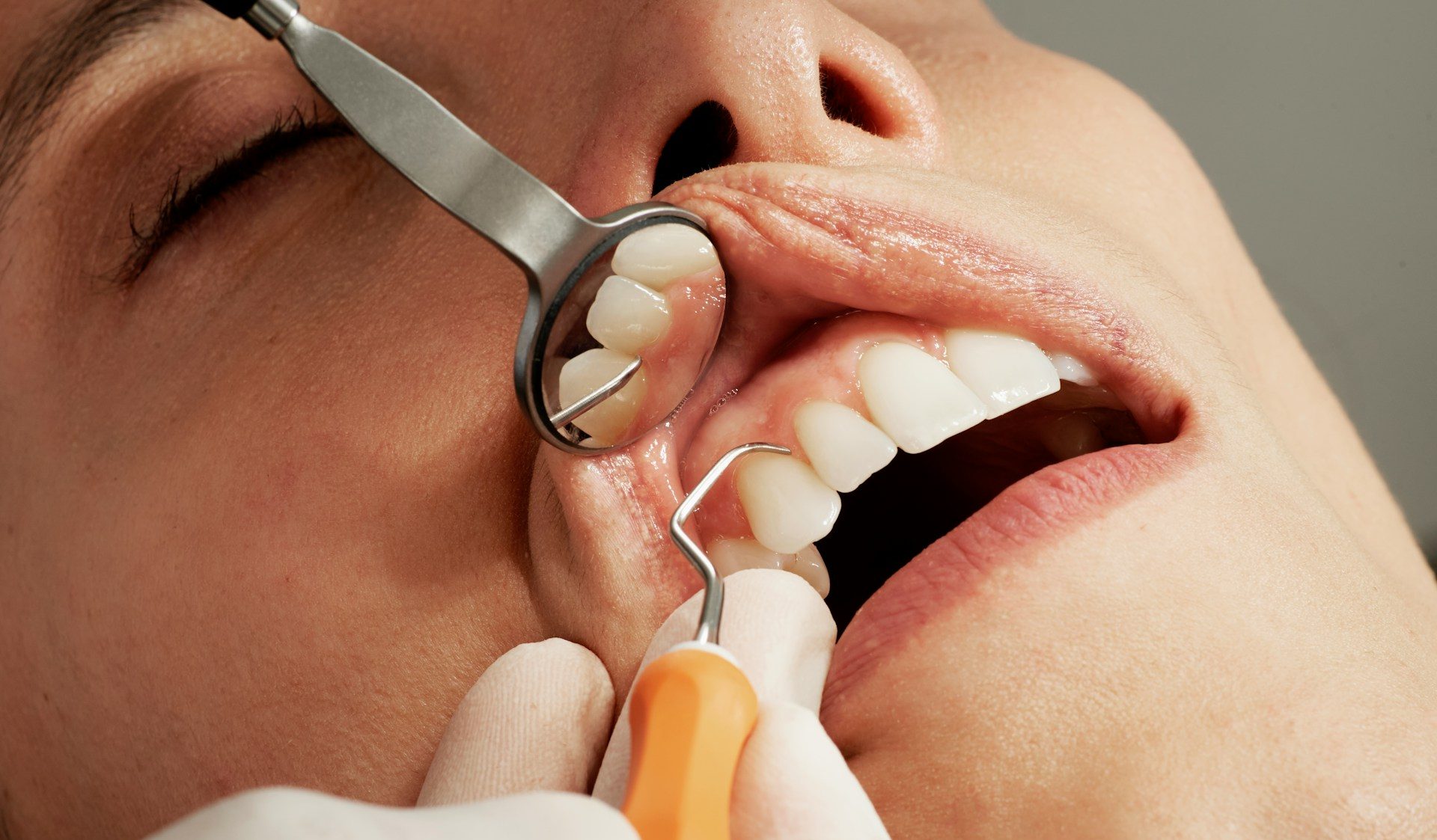 dentist-visit