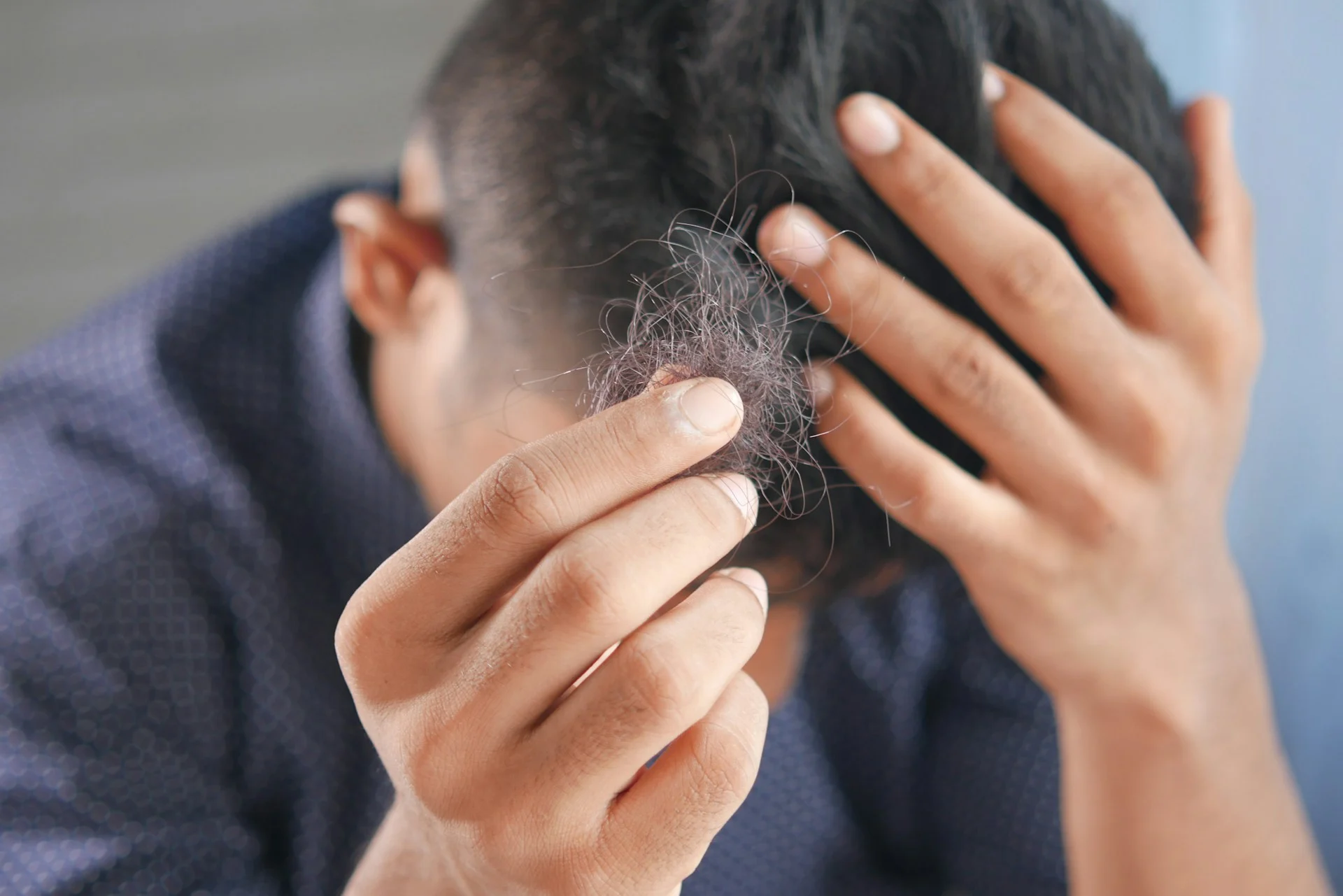 hair-fall