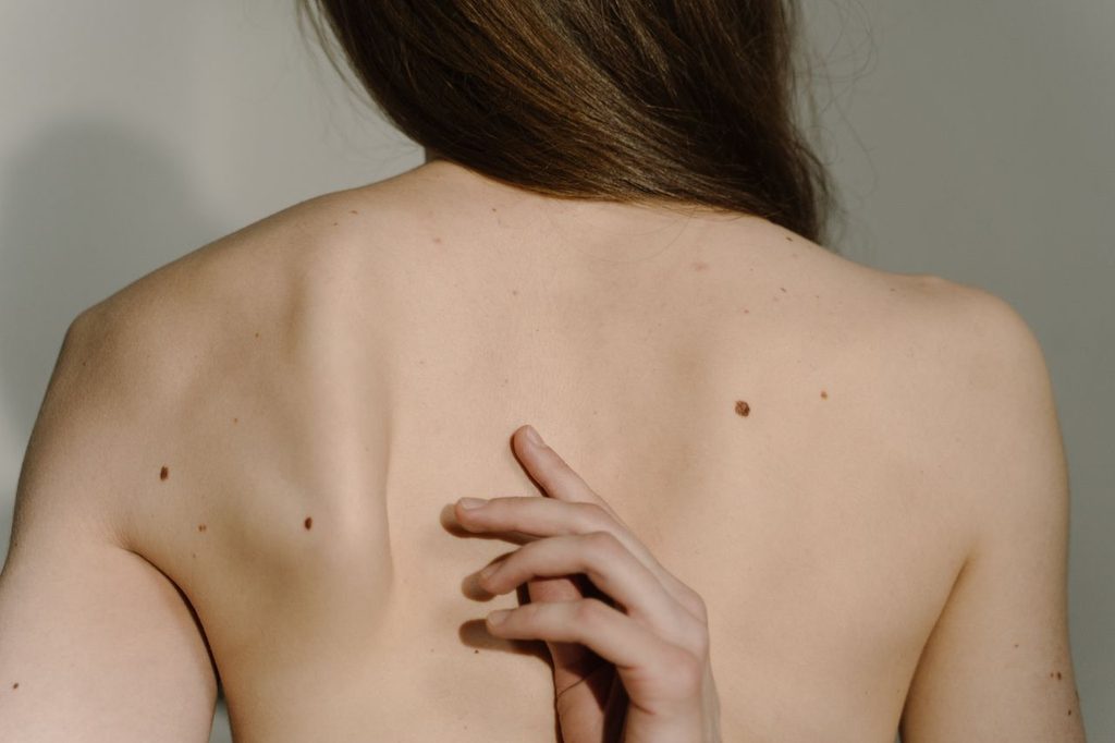 lady-itching-backside