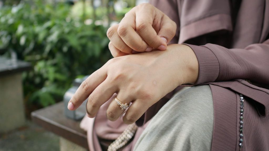 lady-itching-hand-outside