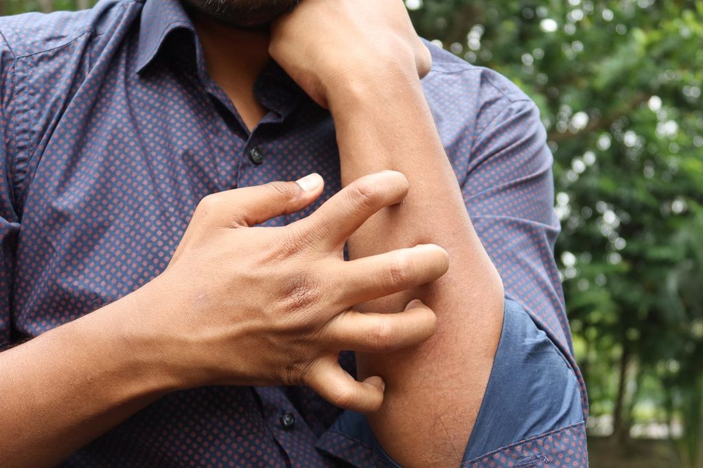 man-itching-hand